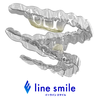 E line smile(イーラインスマイル)