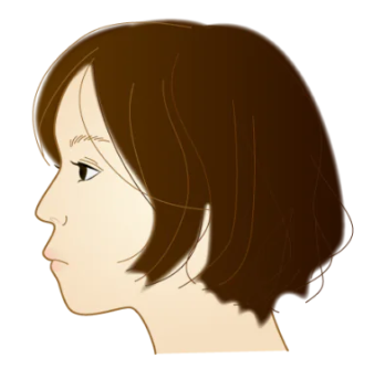 日本人に多い「口ゴボ」は矯正治療で改善できる可能性があります
