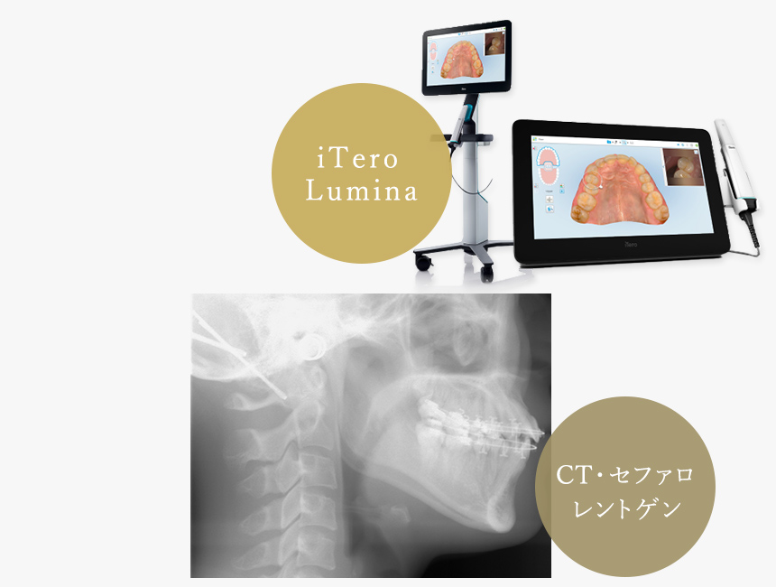 負担の少ない検査と正確な診断 矯正治療開始前に矯正治療のシュミレーションが可能「安心感」につながる治療計画。iTero Lumina、CT・セファロレントゲン