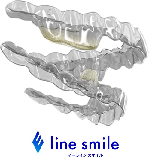 E line smile(イーラインスマイル)