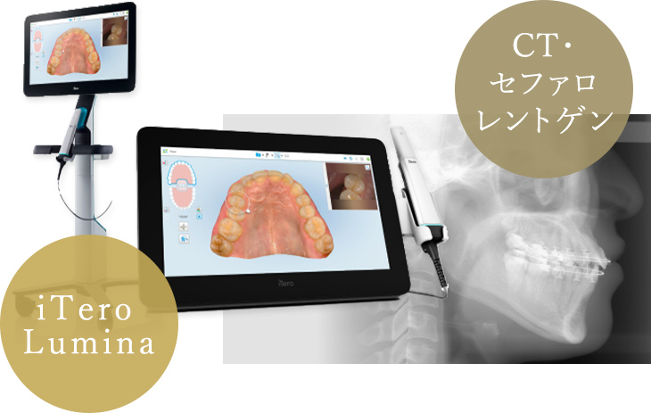 負担の少ない検査と正確な診断 矯正治療開始前に矯正治療のシュミレーションが可能「安心感」につながる治療計画。iTero Lumina、CT・セファロレントゲン